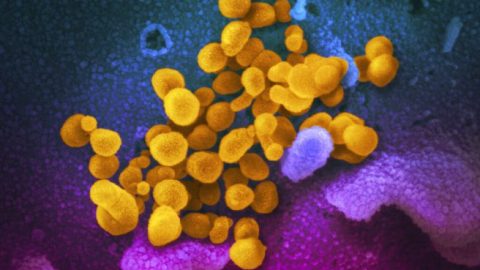 Experts identify two strains of coronavirus in the U.S.