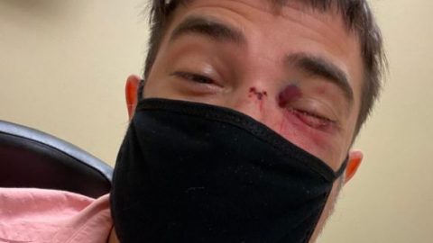 ACLU of Minn. files lawsuit on behalf of journalist hit by rubber bullet during demonstration